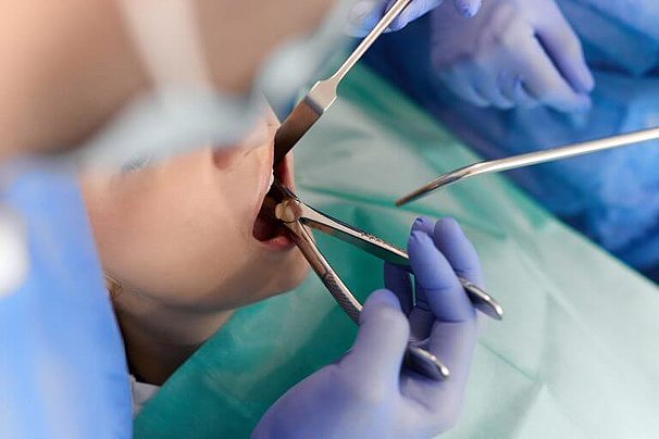 Zahnarzt-Nexte-to-Belleuve-Oralchirurgie-05-768x512.jpg 
