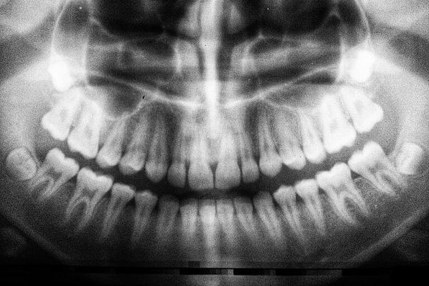 Kariesdiagnostik-2-768x512.jpg 